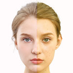 GLOZARA Photon Skin Rejuvenation LED Mask for Home IPL Therapy GLOZARA