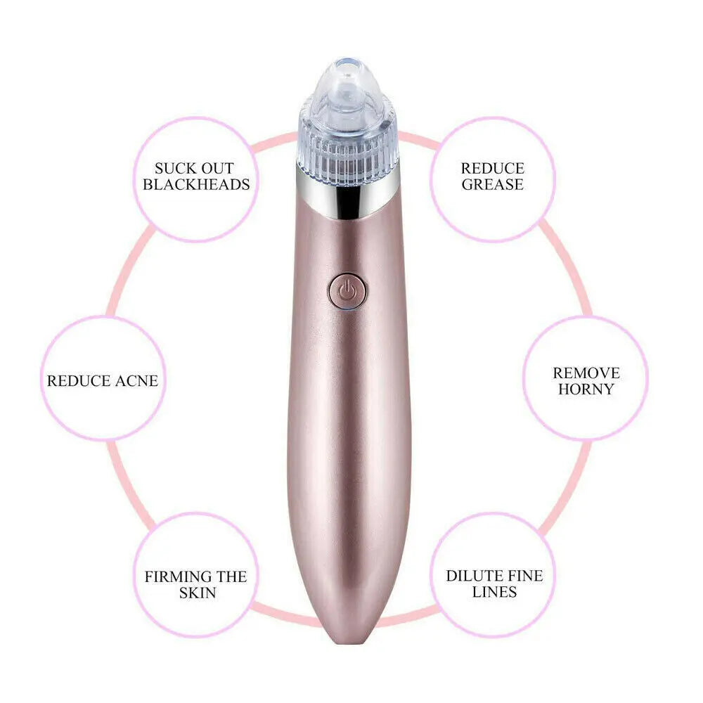GLOZARA Electric Blackhead Remover Pore Vacuum Cleaner with Suction GLOZARA