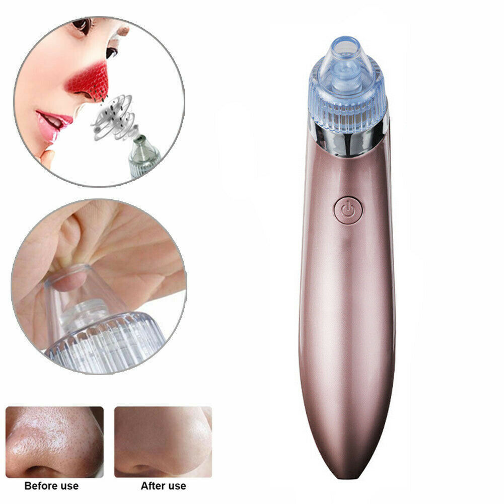 GLOZARA Electric Blackhead Remover Pore Vacuum Cleaner with Suction GLOZARA