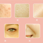 GLOZARA Photon Skin Rejuvenation LED Mask for Home IPL Therapy GLOZARA