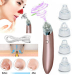 GLOZARA Electric Blackhead Remover Pore Vacuum Cleaner with Suction GLOZARA