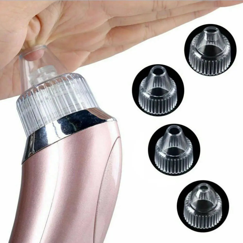 GLOZARA Electric Blackhead Remover Pore Vacuum Cleaner with Suction GLOZARA